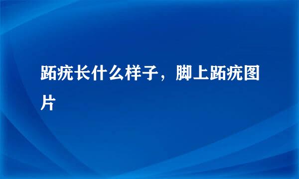 跖疣长什么样子，脚上跖疣图片