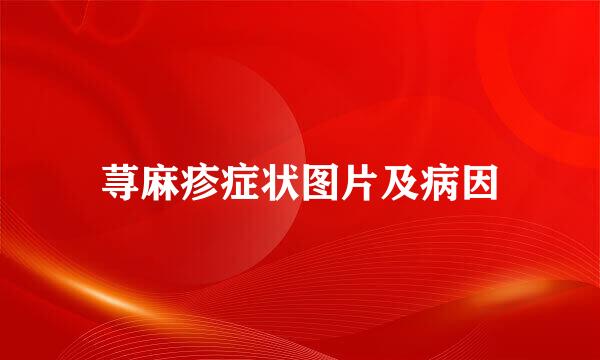 荨麻疹症状图片及病因
