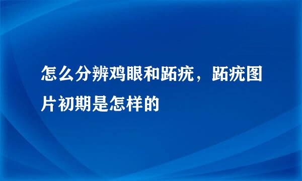 怎么分辨鸡眼和跖疣，跖疣图片初期是怎样的
