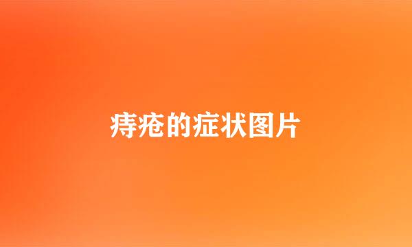 痔疮的症状图片