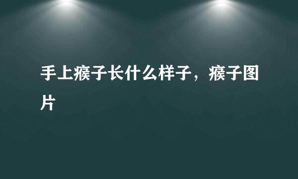 手上瘊子长什么样子，瘊子图片