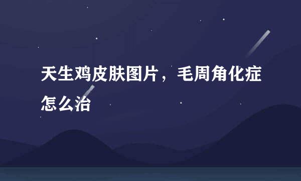 天生鸡皮肤图片，毛周角化症怎么治