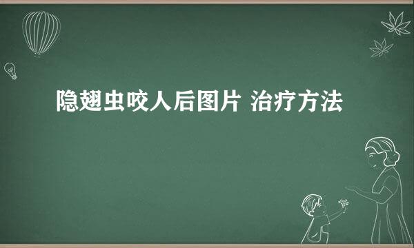 隐翅虫咬人后图片 治疗方法