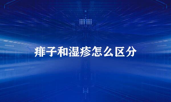 痱子和湿疹怎么区分