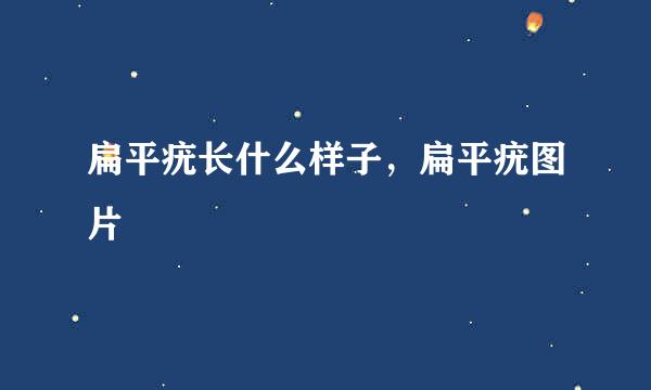 扁平疣长什么样子，扁平疣图片