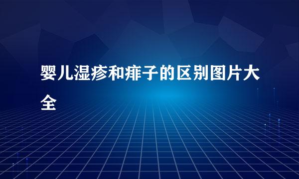 婴儿湿疹和痱子的区别图片大全