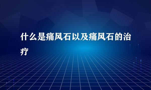 什么是痛风石以及痛风石的治疗
