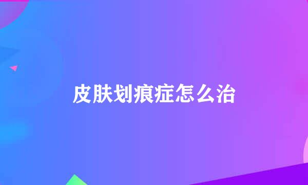 皮肤划痕症怎么治