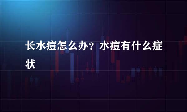 长水痘怎么办？水痘有什么症状