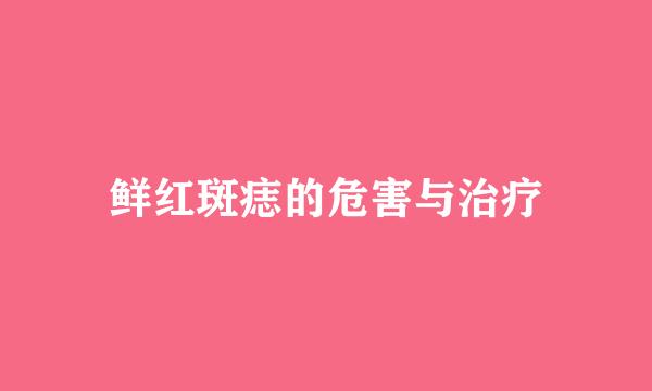 鲜红斑痣的危害与治疗