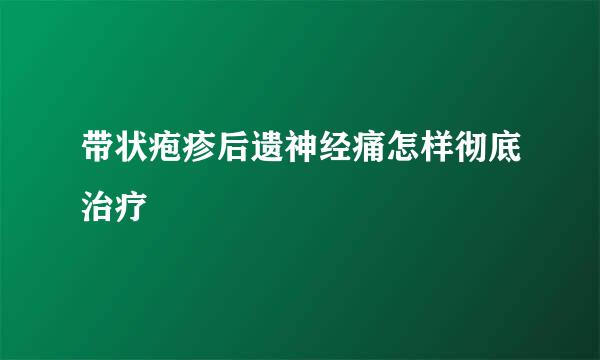 带状疱疹后遗神经痛怎样彻底治疗