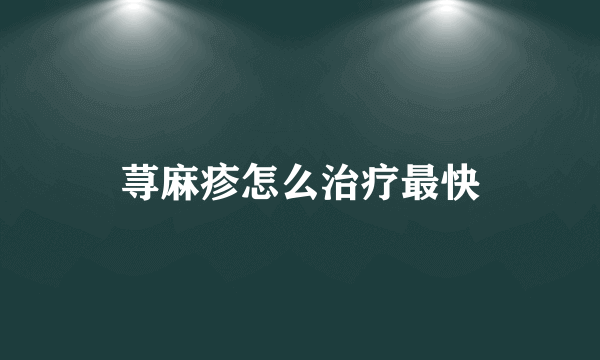 荨麻疹怎么治疗最快