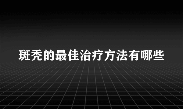 斑秃的最佳治疗方法有哪些
