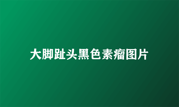 大脚趾头黑色素瘤图片