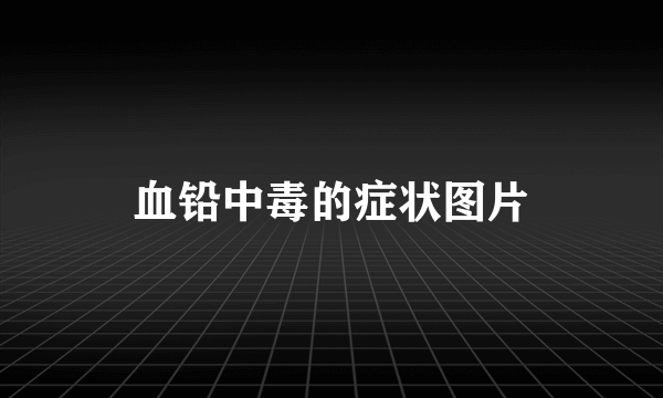 血铅中毒的症状图片