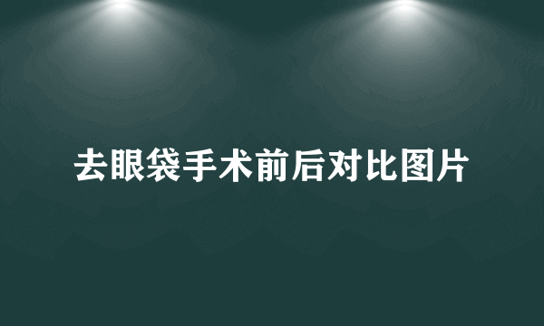去眼袋手术前后对比图片