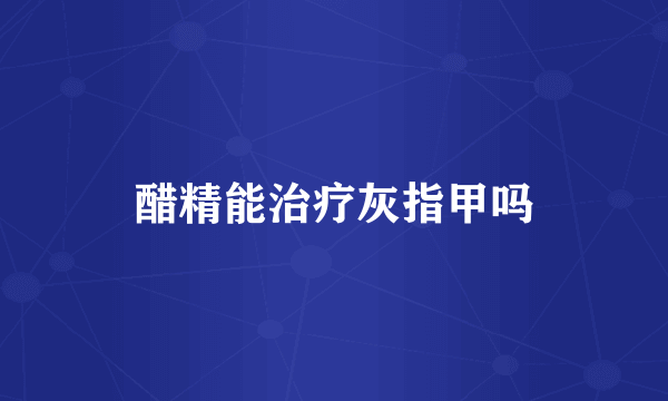 醋精能治疗灰指甲吗