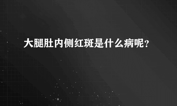 大腿肚内侧红斑是什么病呢？