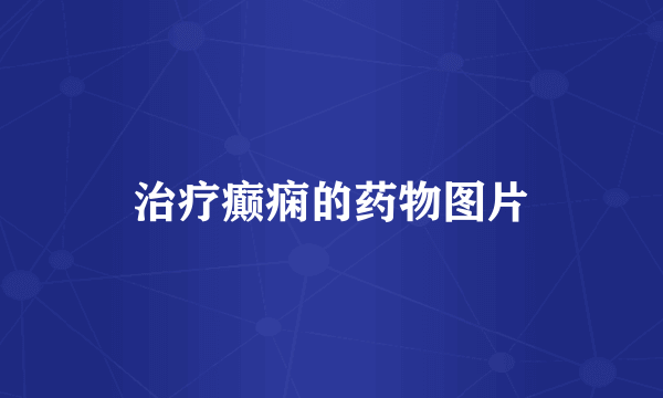 治疗癫痫的药物图片