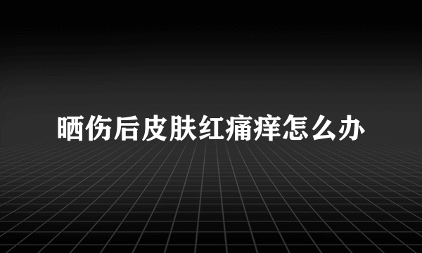 晒伤后皮肤红痛痒怎么办