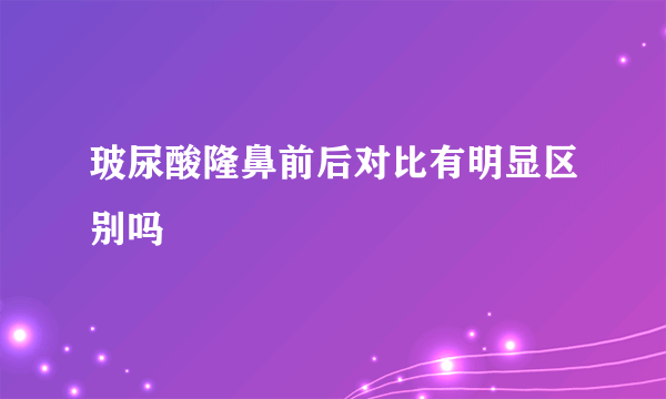 玻尿酸隆鼻前后对比有明显区别吗