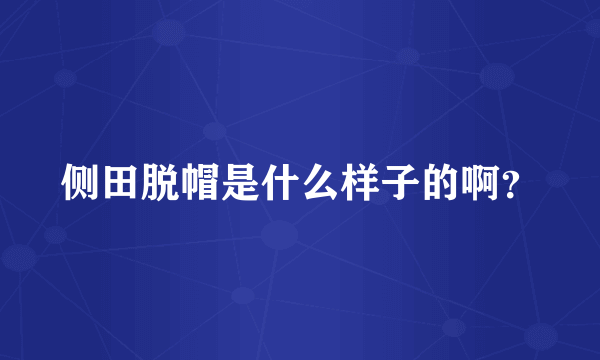 侧田脱帽是什么样子的啊？