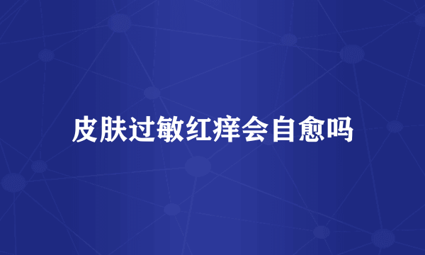 皮肤过敏红痒会自愈吗
