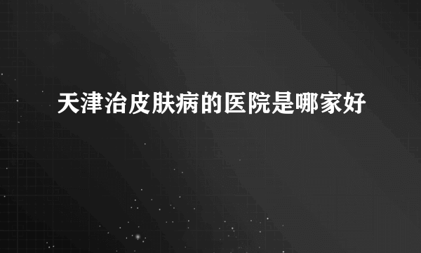 天津治皮肤病的医院是哪家好