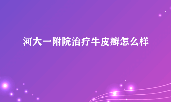 河大一附院治疗牛皮癣怎么样