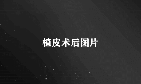 植皮术后图片
