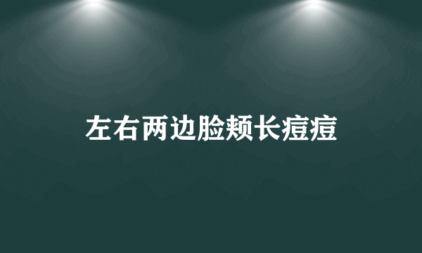 左右两边脸颊长痘痘